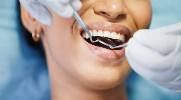 Best Broken or Chipped Tooth Repair in Sheridan, IN